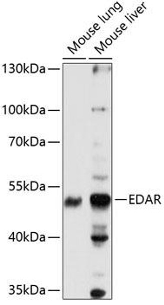 Anti-EDAR Antibody (CAB14105)