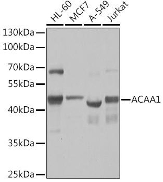 Anti-ACAA1 Antibody (CAB14700)