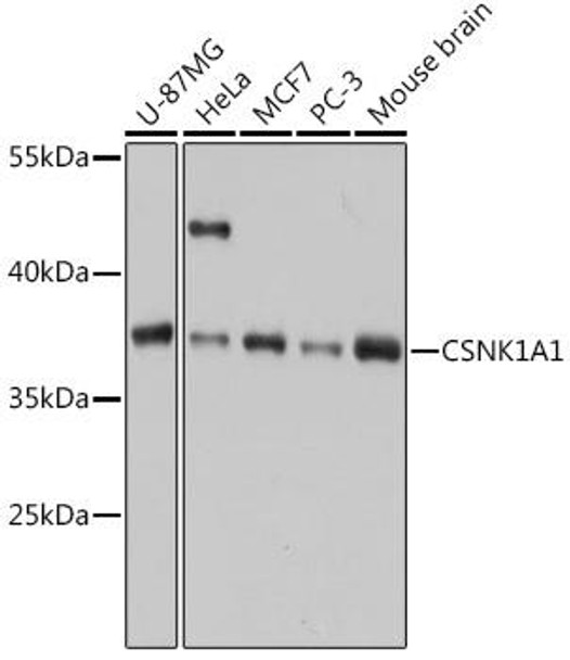 Anti-CSNK1A1 Antibody (CAB16225)