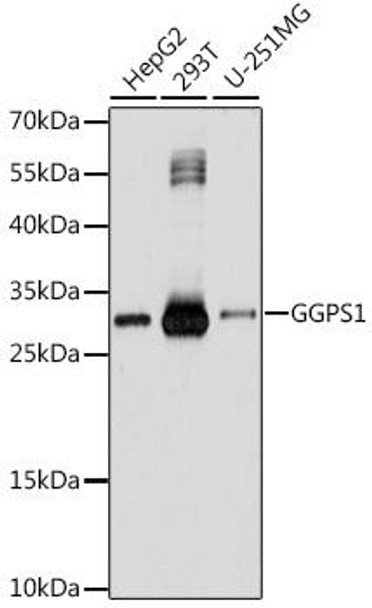 Anti-GGPS1 Antibody (CAB16233)