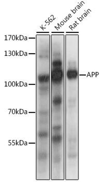Anti-APP Antibody (CAB16265)