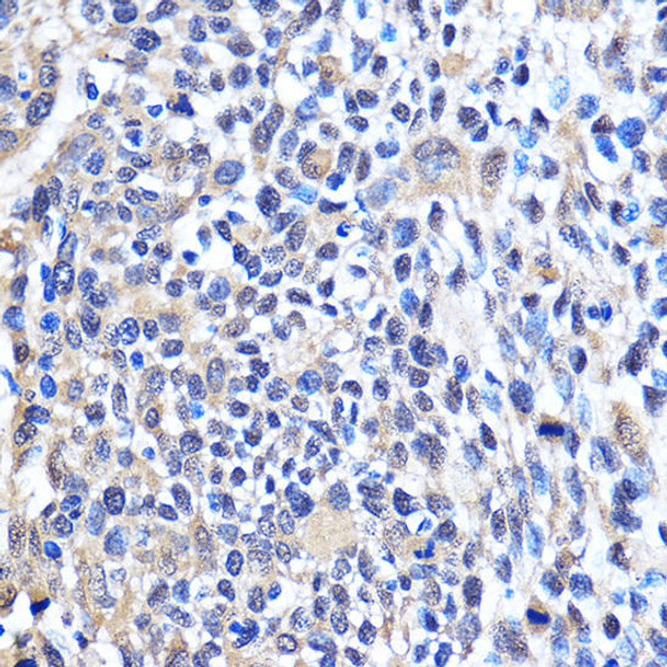 Anti-CDK6 Antibody (CAB16357)