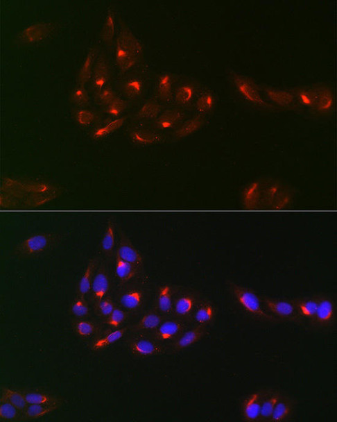 Anti-PDGFRA Antibody (CAB2103)