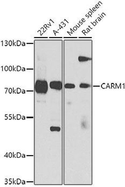 Anti-CARM1 Antibody (CAB2246)