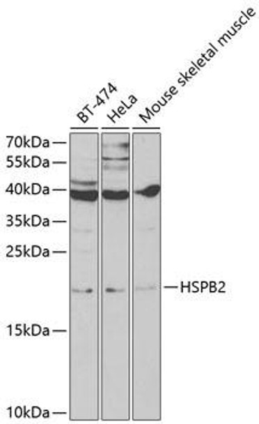 Anti-HSPB2 Antibody (CAB2350)