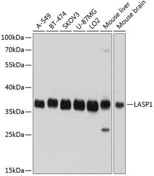 Anti-LASP1 Antibody (CAB3941)