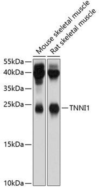 Anti-TNNI1 Antibody (CAB4161)