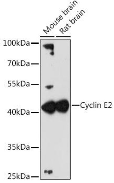 Anti-Cyclin E2 Antibody (CAB4272)