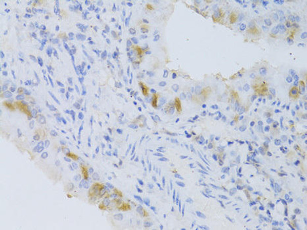 Anti-CYP2C9 Antibody (CAB6219)