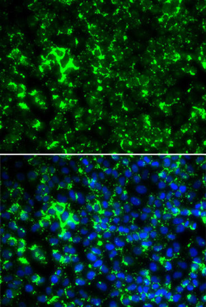 Anti-KCNA2 Antibody (CAB6295)