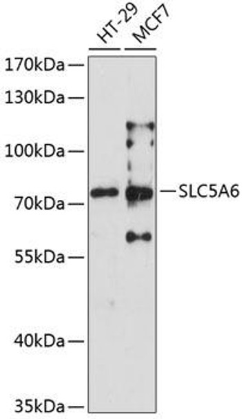 Anti-SLC5A6 Antibody (CAB6434)