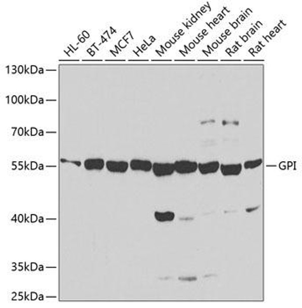 Anti-GPI Antibody (CAB6916)