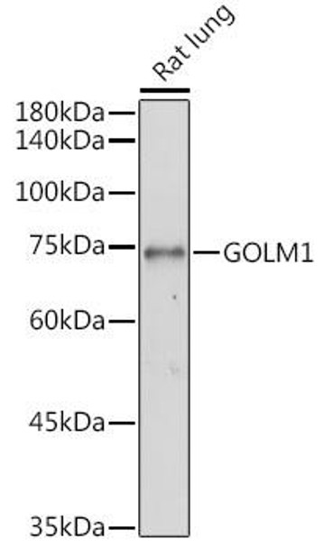 Anti-GOLM1 Antibody (CAB7283)