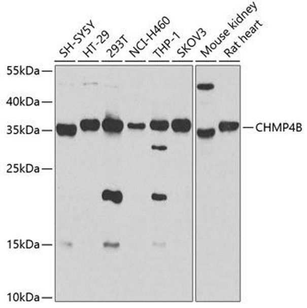 Anti-CHMP4B Antibody (CAB7402)