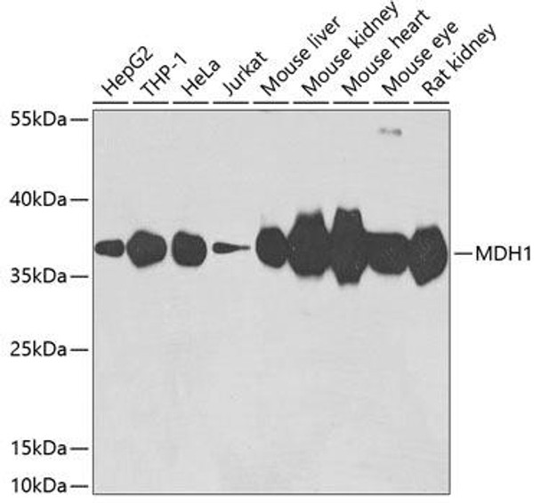 Anti-MDH1 Antibody (CAB7563)