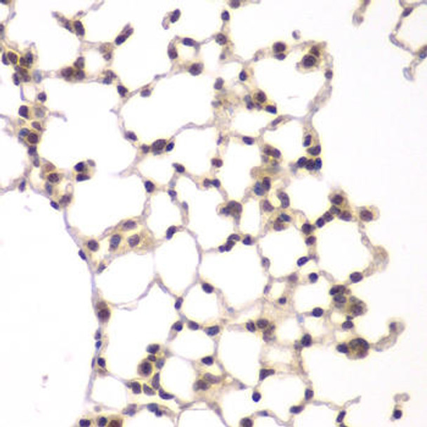 Anti-VRK1 Antibody (CAB7745)