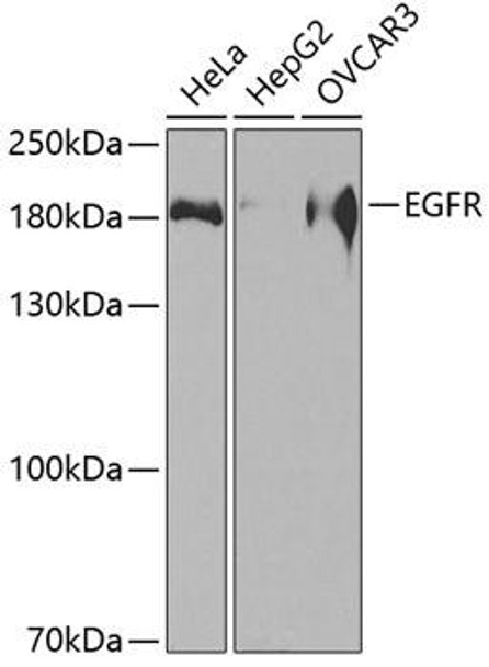 Anti-EGFR Antibody (CAB2909)