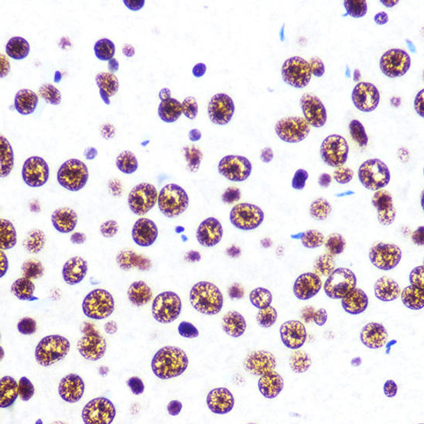 Anti-SFPQ Antibody (CAB3494)