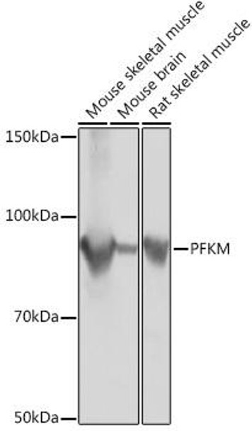 Anti-PFKM Antibody (CAB3671)