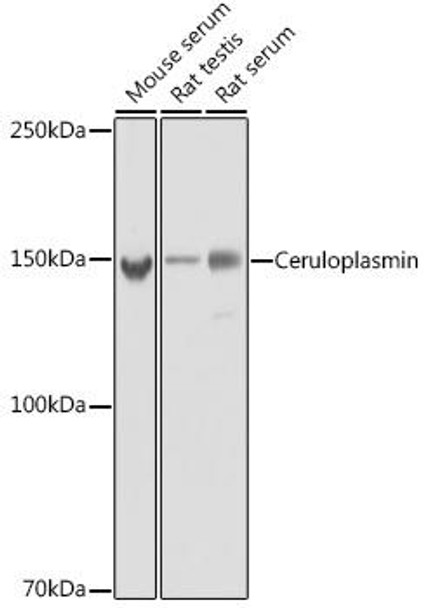 Anti-Ceruloplasmin Antibody (CAB20229)
