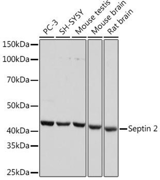 Anti-Septin 2 Antibody (CAB7163)