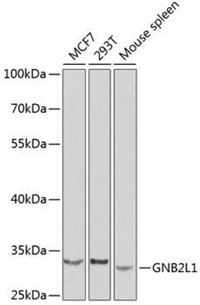 Anti-GNB2L1 Antibody (CAB0151)