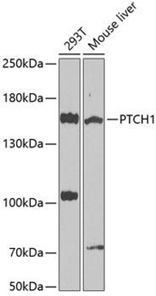 Anti-PTCH1 Antibody (CAB0826)