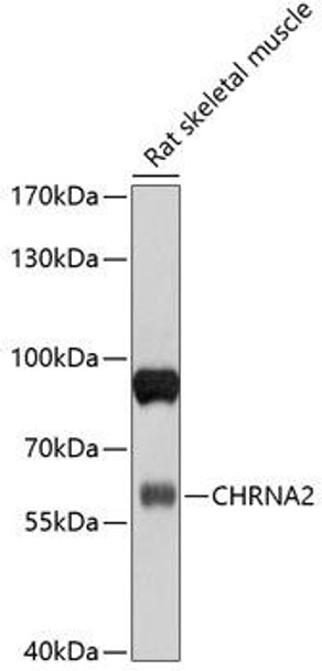 Anti-CHRNA2 Antibody (CAB10056)