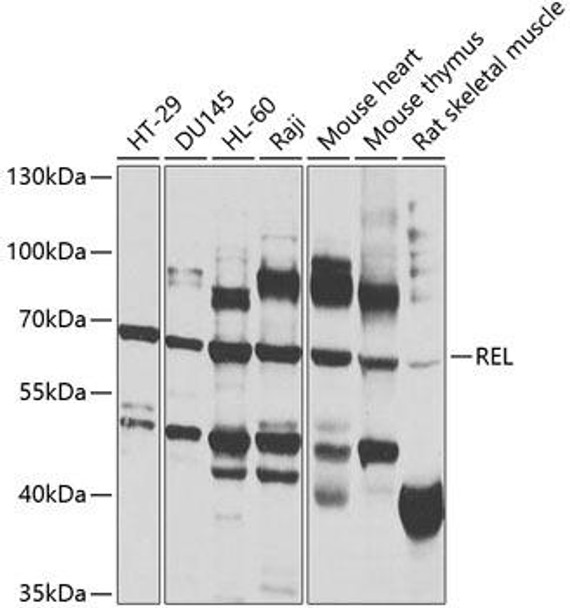 Anti-REL Antibody (CAB1181)