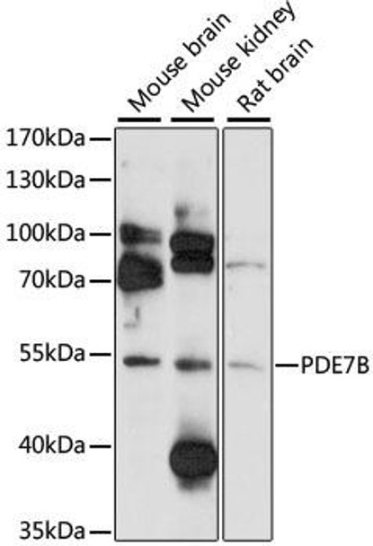 Anti-PDE7B Antibody (CAB12134)