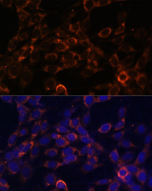 Anti-USE1 Antibody (CAB13151)