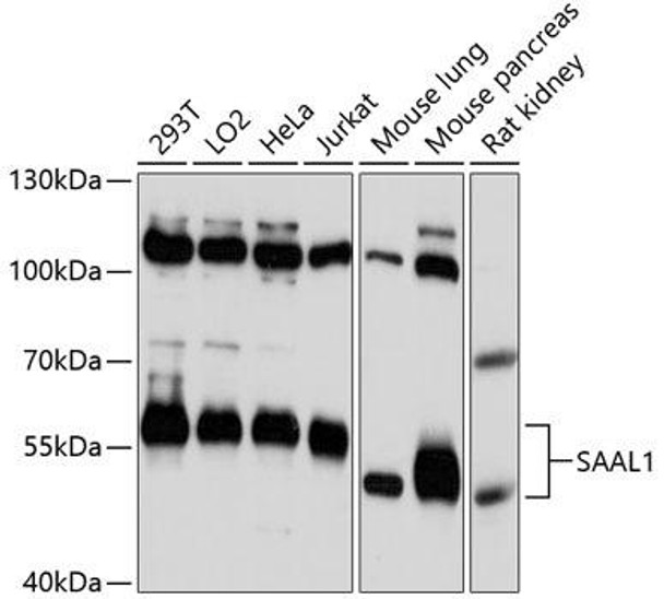 Anti-SAAL1 Antibody (CAB13183)