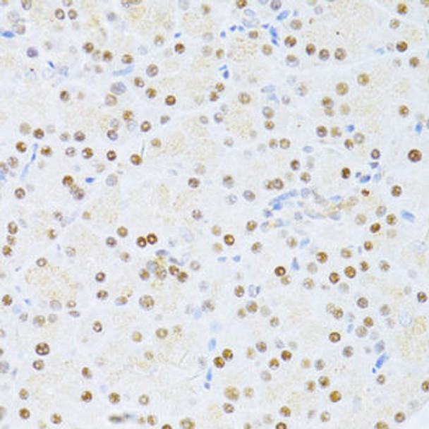 Anti-ETV1 Antibody (CAB13303)