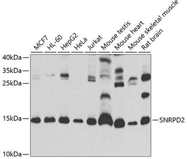 Anti-SNRPD2 Antibody (CAB13356)