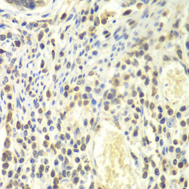 Anti-PSMA4 Antibody (CAB13535)