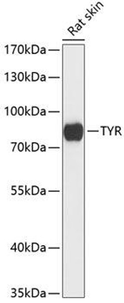 Anti-TYR Antibody (CAB13608)