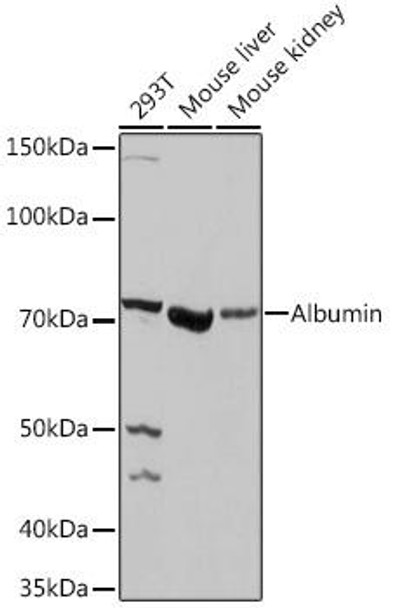Anti-Albumin Antibody (CAB1363)