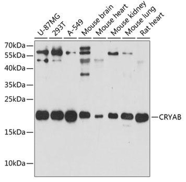 Anti-CRYAB Antibody (CAB13696)