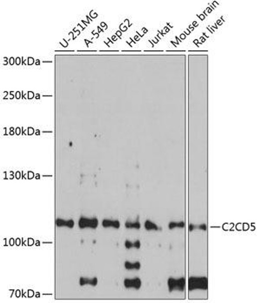 Anti-C2CD5 Antibody (CAB14357)