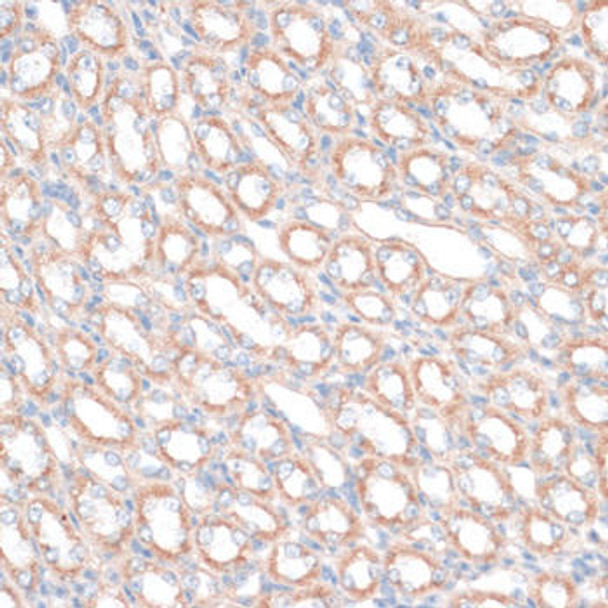 Anti-PDGFD Antibody (CAB14653)