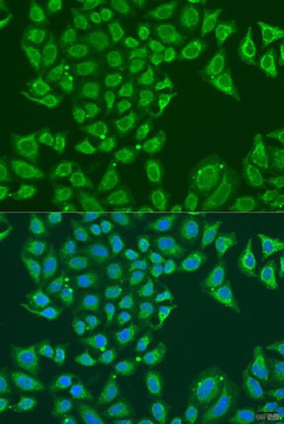 Anti-ALDH1B1 Antibody (CAB15025)