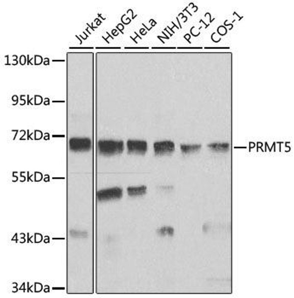 Anti-PRMT5 Antibody (CAB1520)