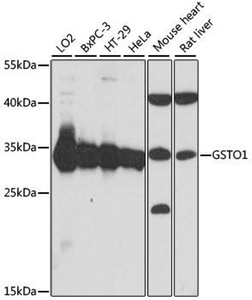 Anti-GSTO1 Antibody (CAB15354)