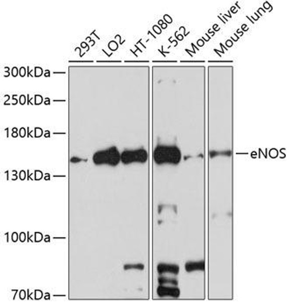 Anti-eNOS Antibody (CAB1548)