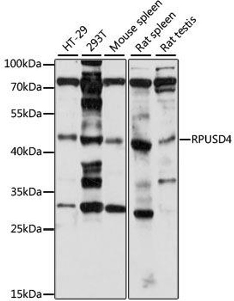 Anti-RPUSD4 Antibody (CAB15538)