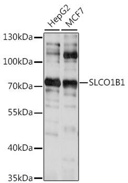 Anti-SLCO1B1 Antibody (CAB15783)