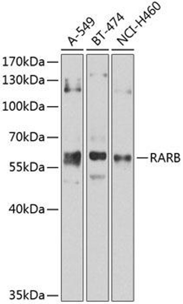 Anti-RARB Antibody (CAB1603)