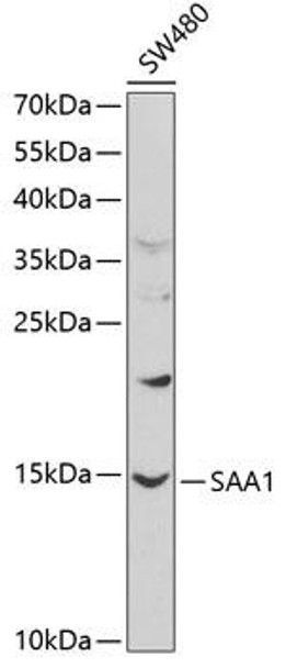 Anti-SAA1 Antibody (CAB1655)