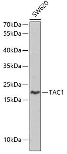 Anti-TAC1 Antibody (CAB1666)