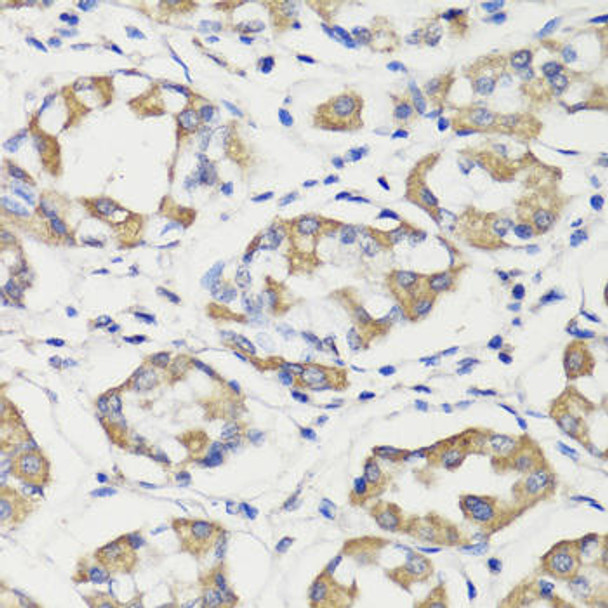 Anti-DEPDC6 Antibody (CAB17305)